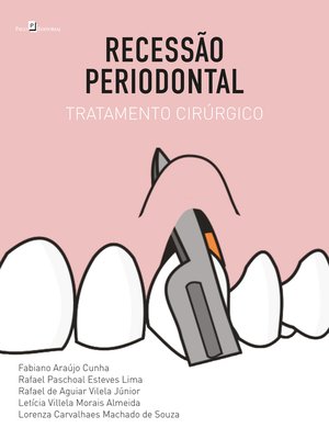 cover image of Recessão Periodontal